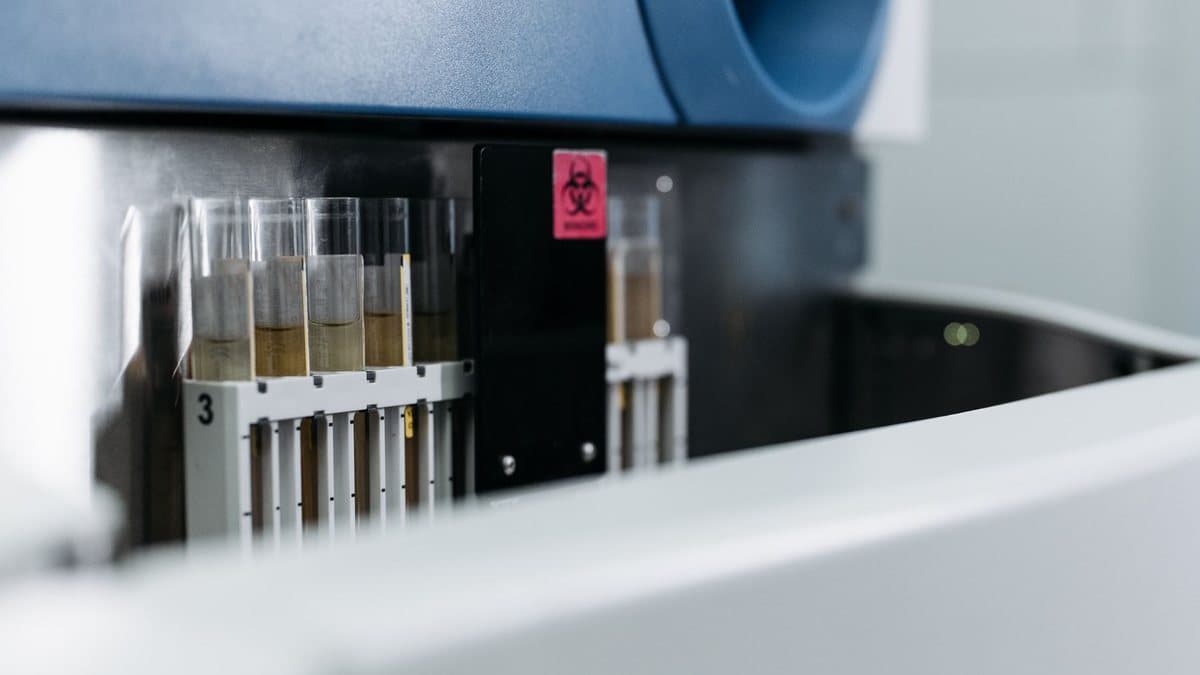 Test tubes containing yellowish liquid are arranged in a rack within a laboratory machine, marked with a biohazard symbol.