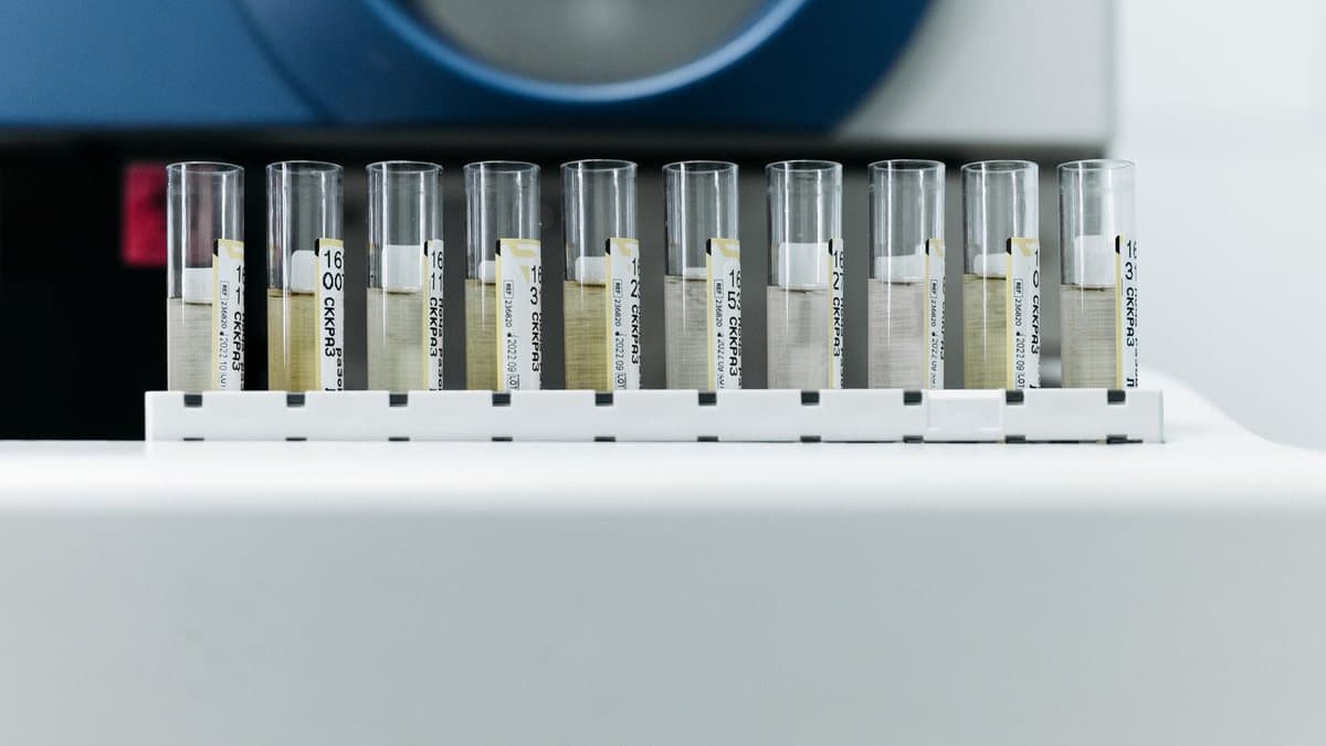 A white rack holds eleven labeled glass tubes filled with light-colored liquids on a bright counter.